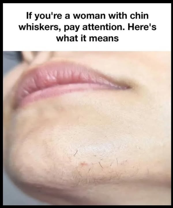 Chin Whiskers